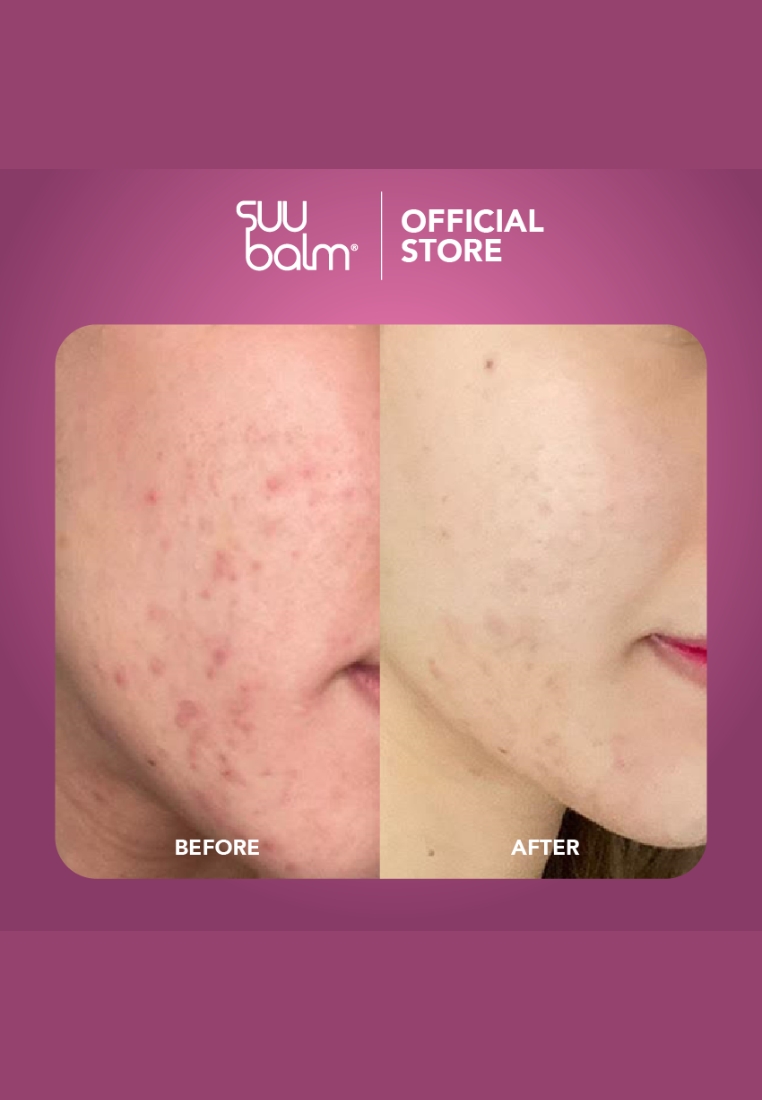 Suu Balm Cooling Itch Relief Facial Moisturiser
